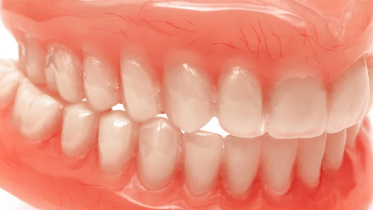 Dentures at Buttercross Dental Practice
