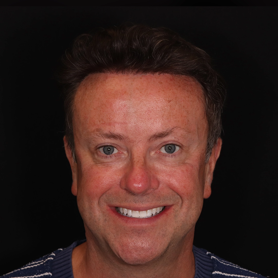 Patient result