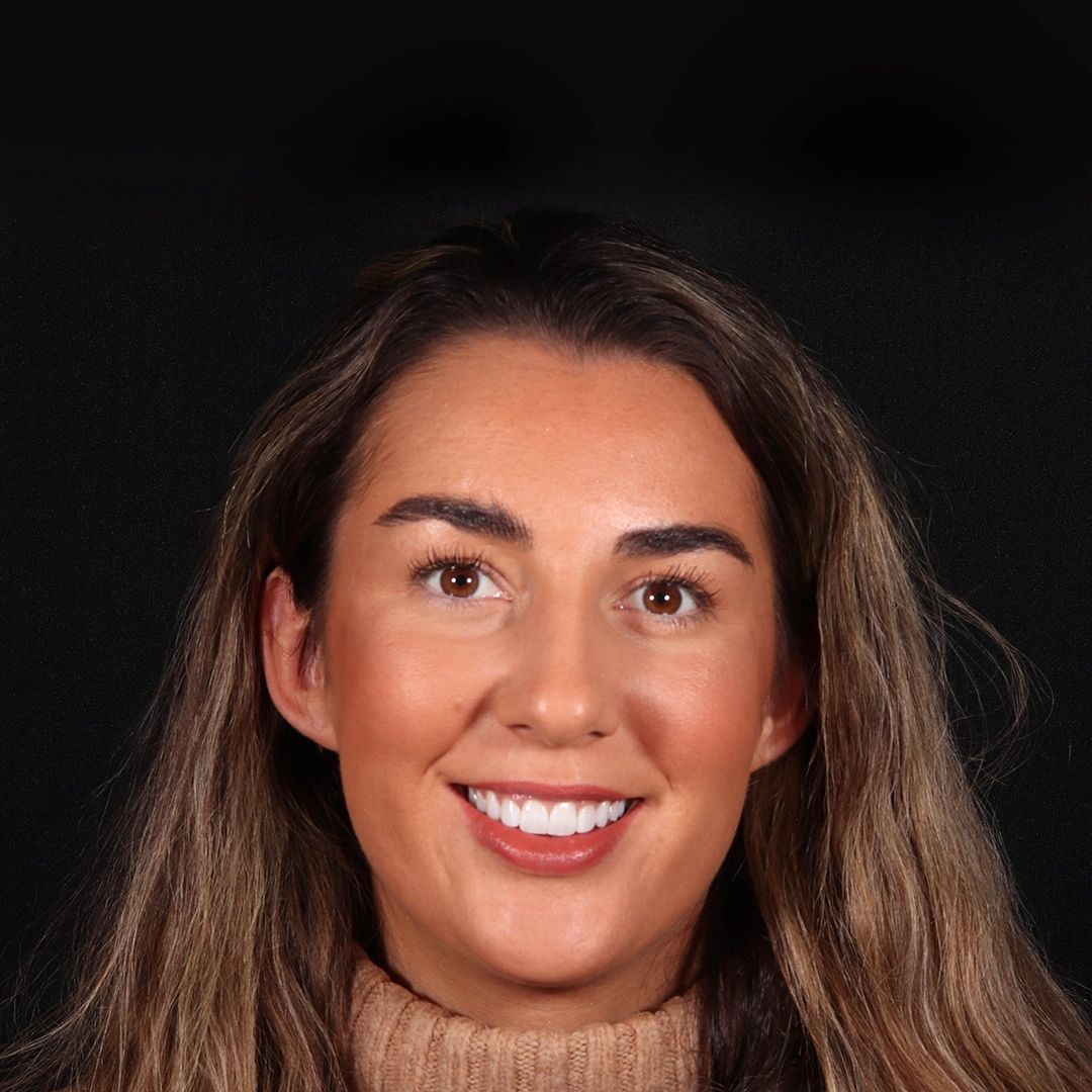 Composite bonding result — Sophia G