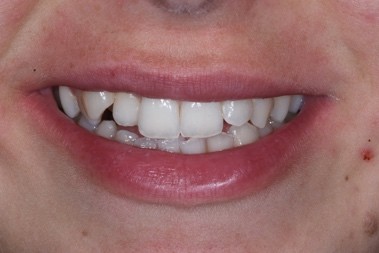 Before — Case C