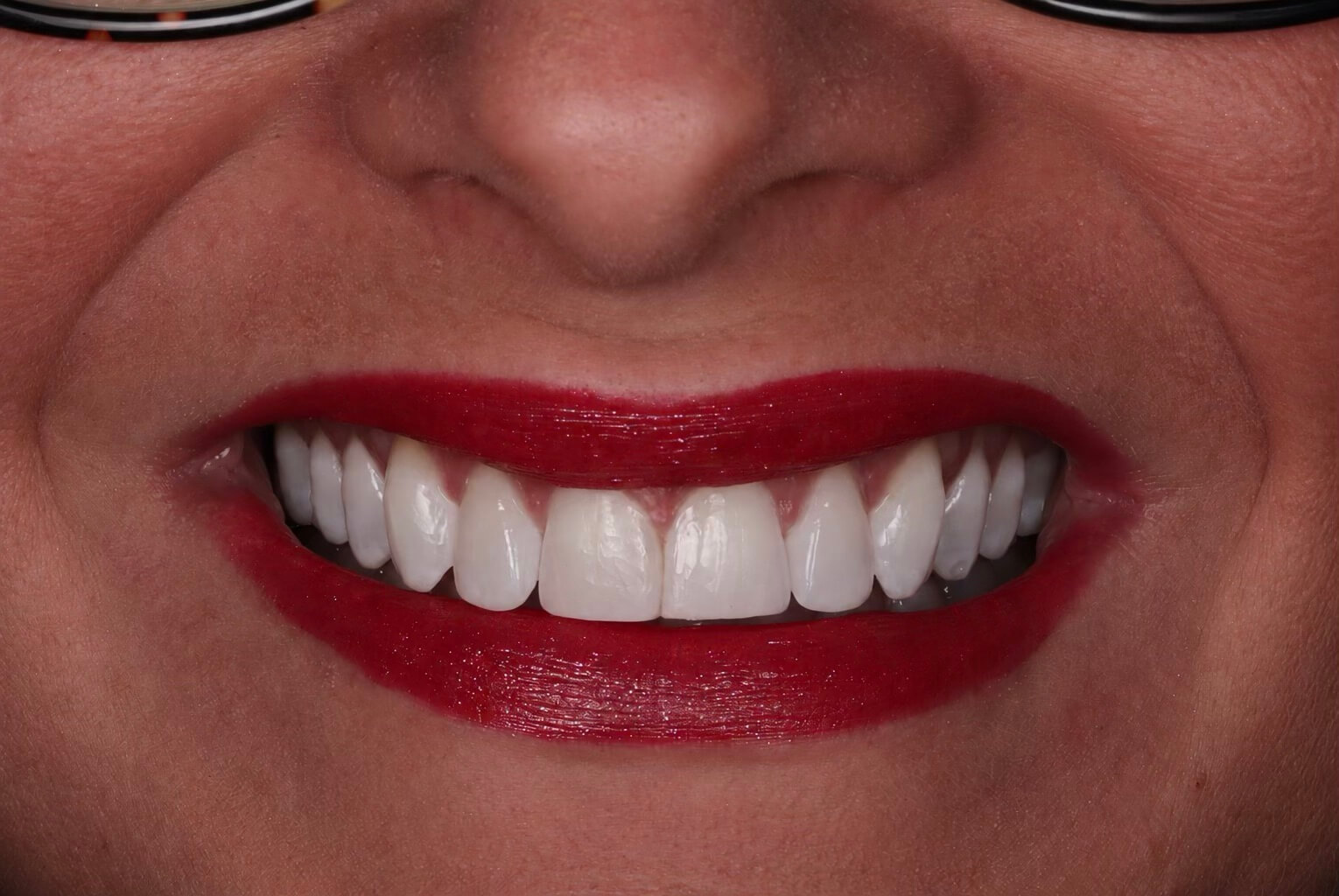 Buttercross Dental Practice gallery photo 3